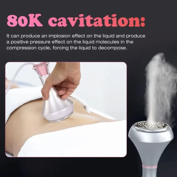 80K Cavitation 80K Cavitation