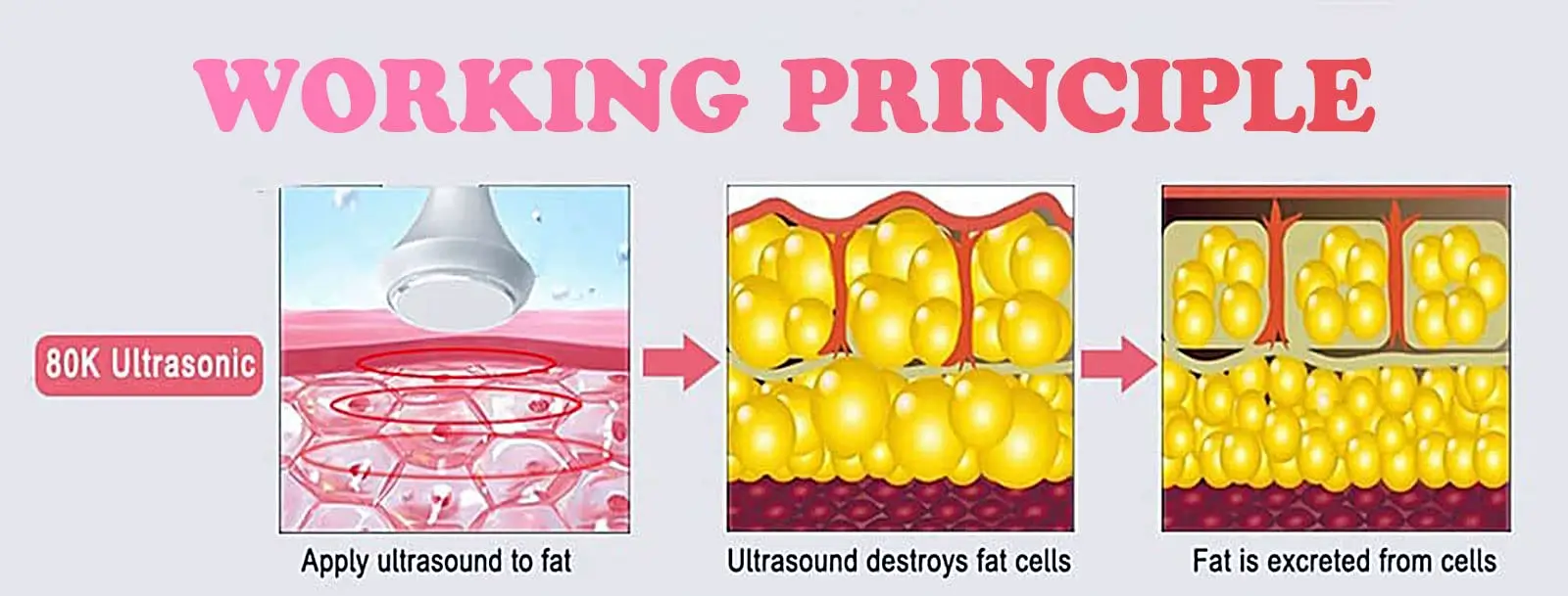 How 80K Ultrasonic Cavitation Works