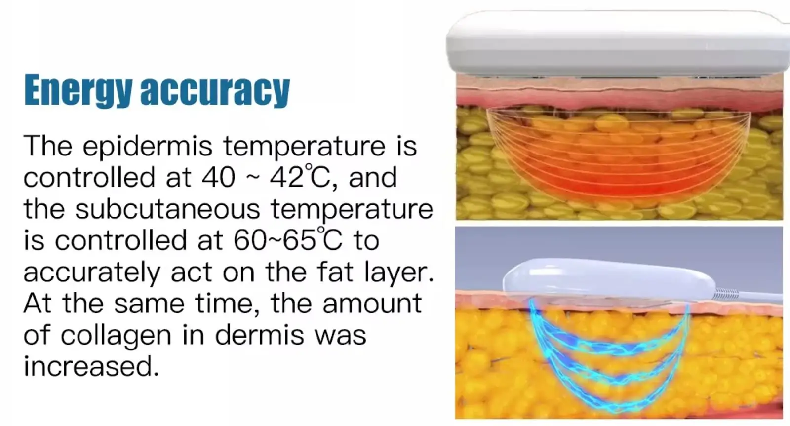 laser lipo cavitation machine