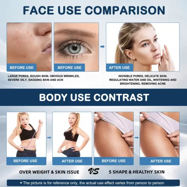 Performance for cavitation machine - beauslimmer